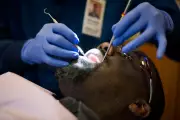 Before Letting Your Dentist Drill: Key Facts About Cavities