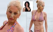 Big Brother Star Nadia Almada Shows Off Facelift Results on Turkey Beach