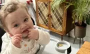 Bite mark on baby adopted by teacher and boyfriend before death, court hears