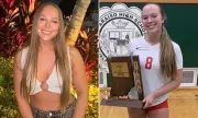 College Volleyball Player's Wisdom Teeth Removal Leads to Leukemia Diagnosis