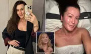 Cortisol Face: The Stress Trend That's Making Women Obsess Over Puffiness