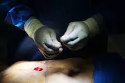 Cosmetic Interventions Surge Sparks Ethical Debates Across Society