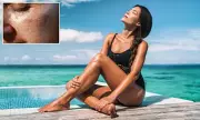 Daily Grape Consumption Alters Skin Gene Activity to Boost UV Protection
