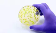FDA Probes Salmonella Typhimurium Outbreak Sickening 16, Source Unknown