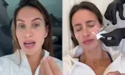 Ferne McCann Shows Off Botox Results After Jaw and Forehead Treatment