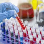 Hantavirus Vials Vanished from Australian Lab in 2024 Ahead of Cruise Outbreak
