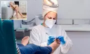 HPV Foot Warts: Silent Infection Risks and Treatments Explained