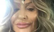 Katie Price Accused of Exploiting Missing Husband by Mother-in-Law