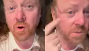 Keith Lemon actor Leigh Francis clawed in face by overzealous fan during DJ set