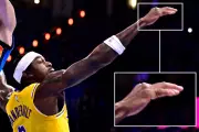 Lakers' Jarred Vanderbilt Suffers Gruesome Pinkie Fracture in Playoff Game