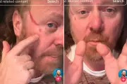 Leigh Francis Jokes Facial Injury During DJ Set Could Have Been Worse