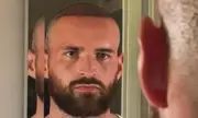 Love Island Star Ronnie Vint Debuts New Look After Hair Transplant