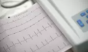 Low Resting Heart Rate May Also Signal Stroke Risk, Study Finds