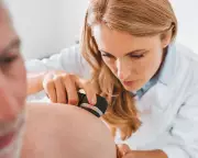 Melanoma Skin Cancer Cases in UK Reach Record High, Charity Warns