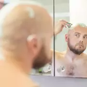 Men Shave Heads to Cope with Hair Loss, Insist 'Problems Fade Away'