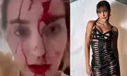 Miss Venezuela Bloodied in Hotel Attack by Celebrity Stylist at Cannes
