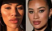 Montana Brown Regrets Facial Fillers, Warns Against Cosmetic Procedures