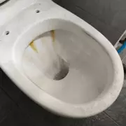 Natural Solution Removes Yellow Toilet Stains in 60 Minutes