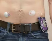 NHS Artificial Pancreas Rollout Reduces Diabetes Care Inequality