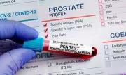 Prostate Cancer Screening Could Save Thousands of Lives, Landmark Review Finds