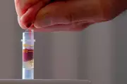 Simple Blood Test Could Detect Alzheimer’s Decades Before Symptoms
