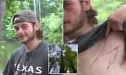 Teen Survives Lightning Strike While Fishing, Returns to Water Next Day