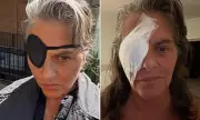 Tracey Emin Recovers from Eye Surgery After Months of Partial Blindness