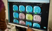 UK's First AI-Powered Fertility Clinic Offers Hope to Infertile Couples