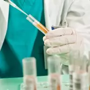 Urine test for 'zombie cells' could predict lung cancer within five years
