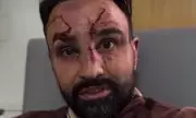 US boxer Paulie Malignaggi slams NHS care after bare-knuckle fight in Leeds