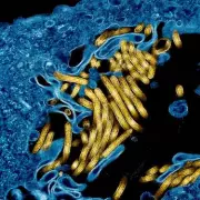 WHO Admits Ebola Outbreak Began Months Before Detection After US Criticism