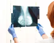 Why Routine Cancer Screenings Have Age Limits Explained