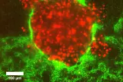 Why Smaller Cancer Cells Lead to Worse Prognosis: New Study