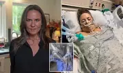 Woman Left in Coma After Robotic Hysterectomy Sues Hospital