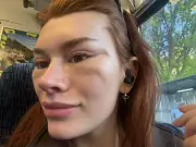 Woman Spends £6k on Turkey Facelift, Trolls Mock 'Kebab Shop' Surgery