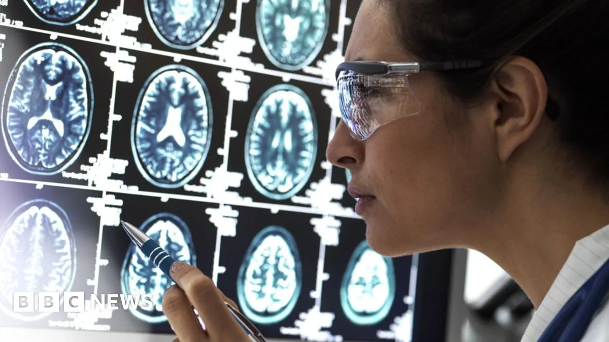 Alzheimer's Drug Lecanemab Hailed as Breakthrough, Slows Cognitive Decline