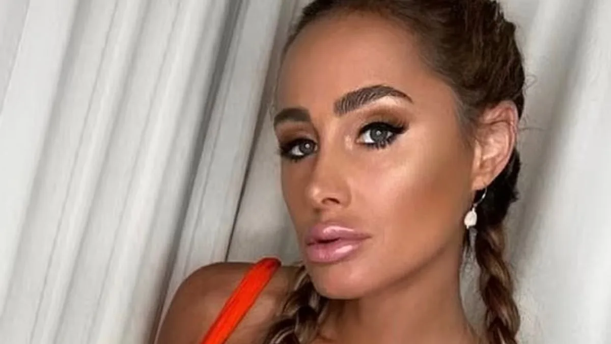 Australian Model Dies in Bali Hotel Balcony Fall