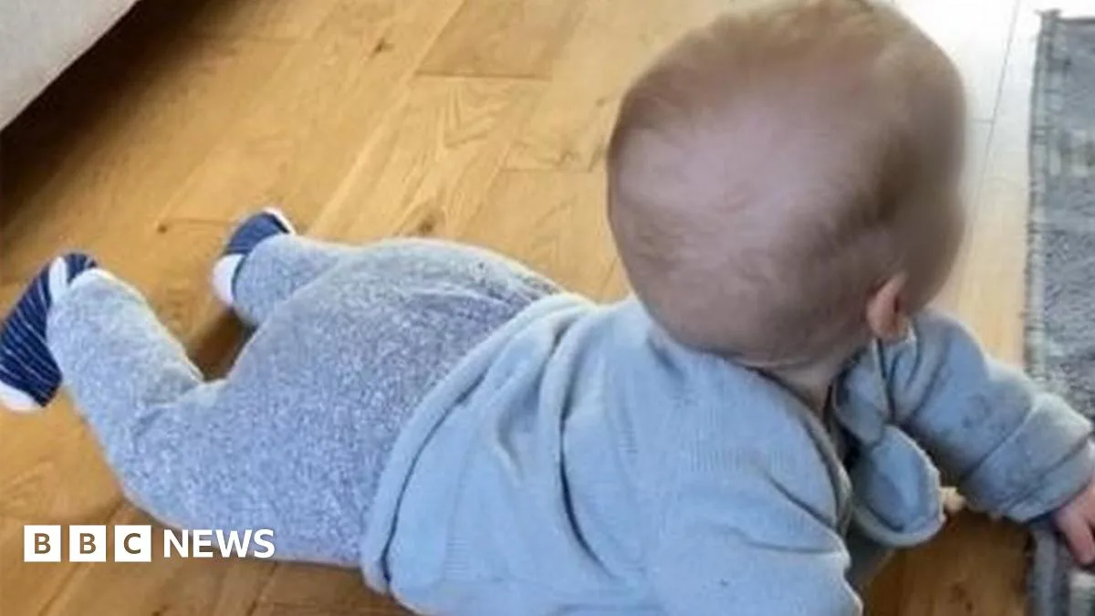 Misdiagnosed Fractures Led to Children Being Taken into Care