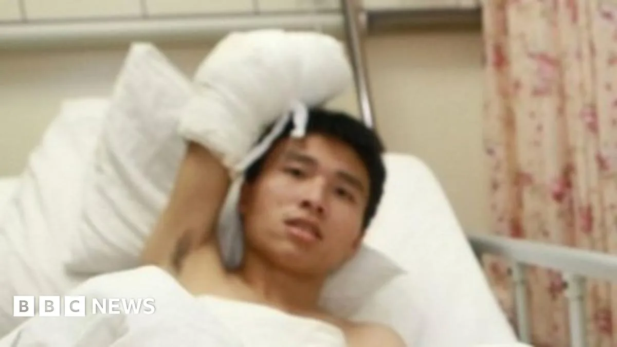 Severed Hand Kept Alive on Man's Ankle in Groundbreaking Surgery