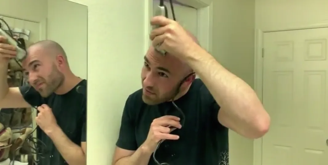 Baldness Forum Goes Viral With Shaved Head Transformations