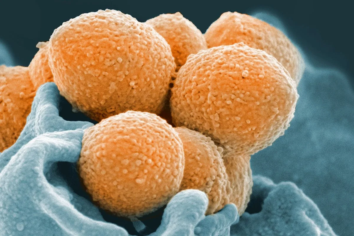 Fourth Child Dies from Strep A Infection as Cases Rise