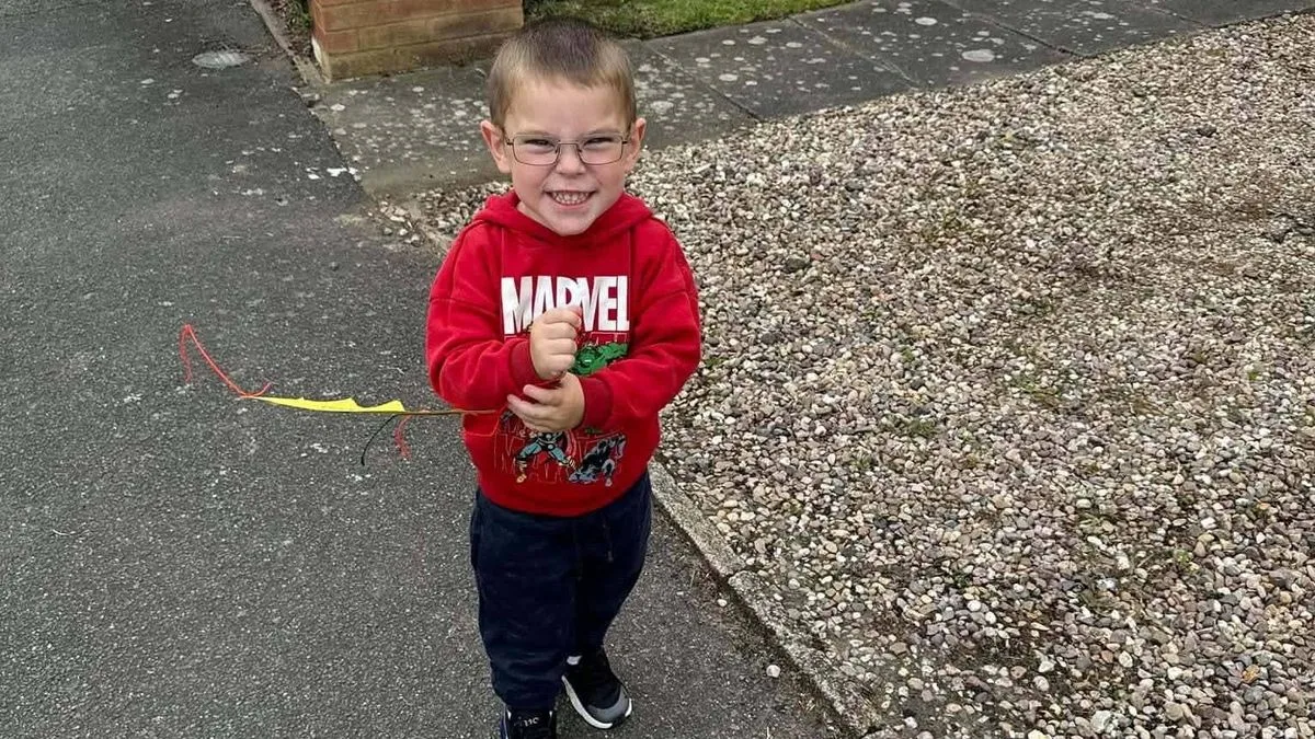Boy, 5, Left with Hole in Skull After E-Scooter Collision