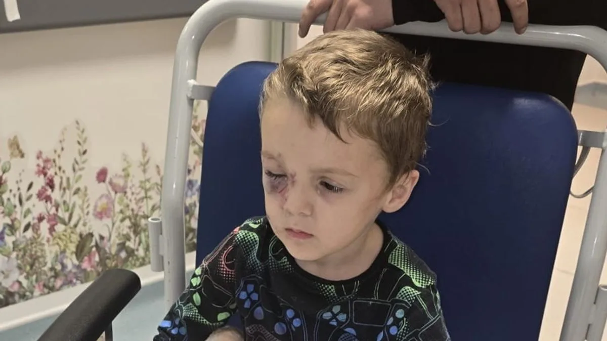 Five-Year-Old Boy Mauled by Aggressive Dog in Doncaster Park