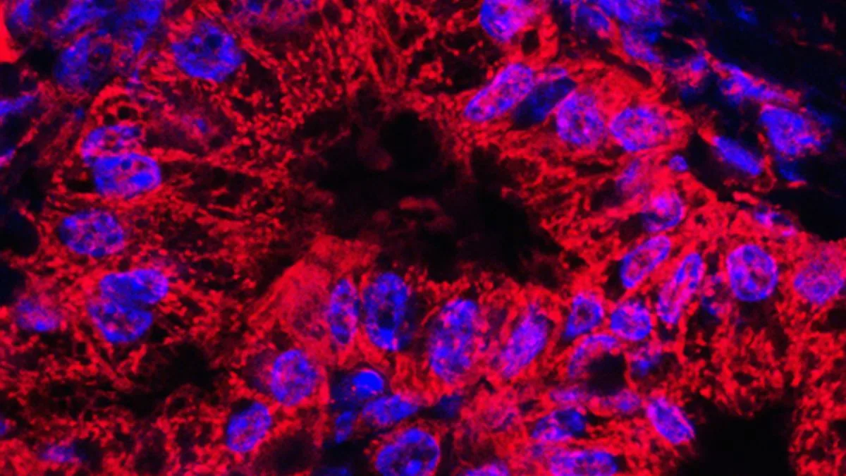 Two Early Warning Signs of 'Silent Killer' Pancreatic Cancer Brits Should Never Ignore