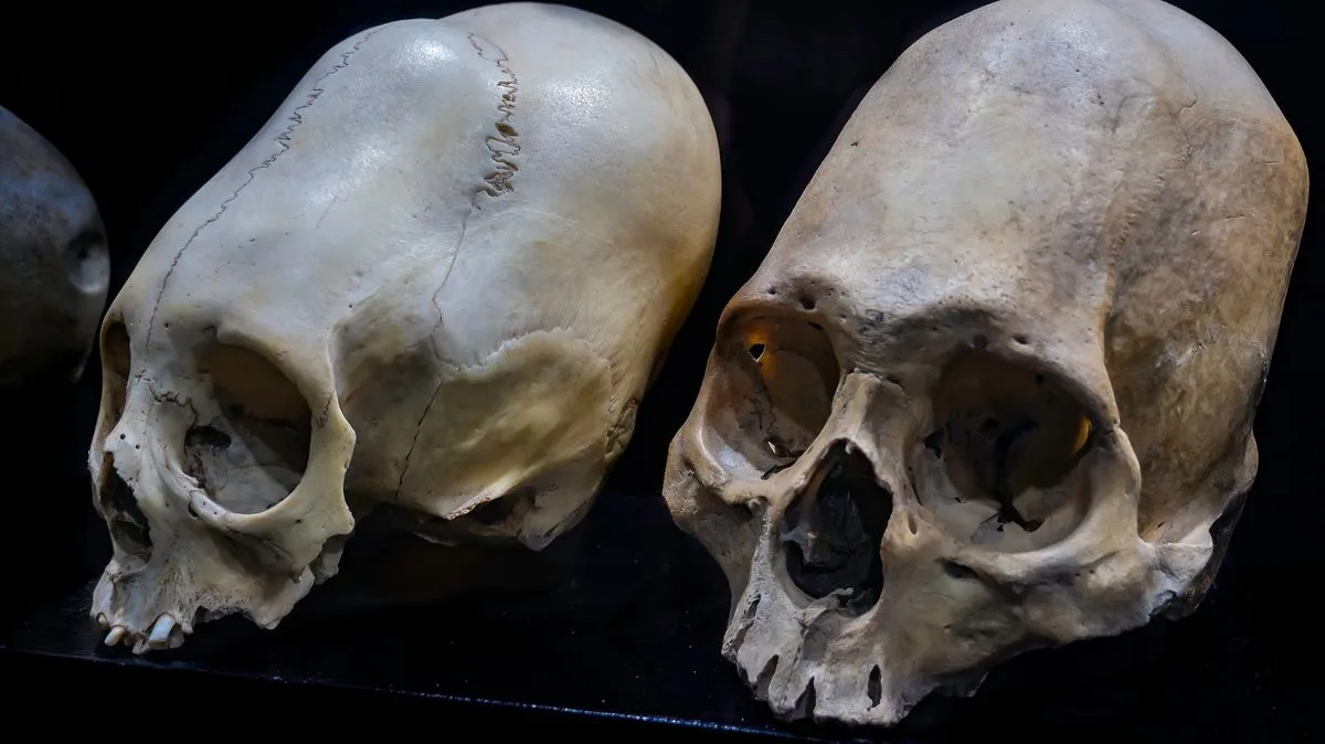 Conehead Mummy DNA Study Fails to Prove Alien Links