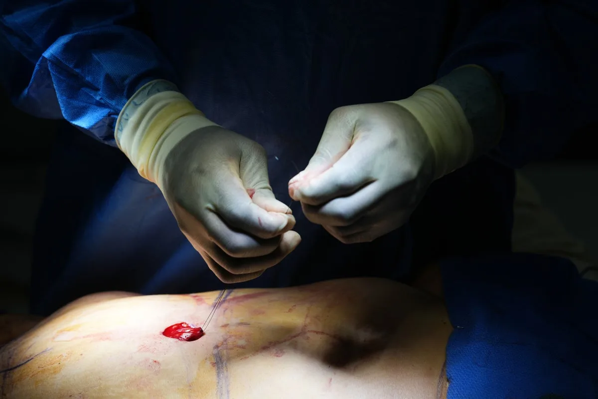 Cosmetic Interventions Surge Sparks Ethical Debates