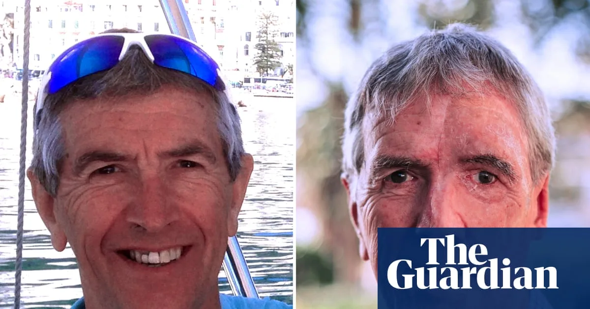 Cyclist, 75, Receives 3D-Printed Face After Drunk Driver Caused Severe Burns