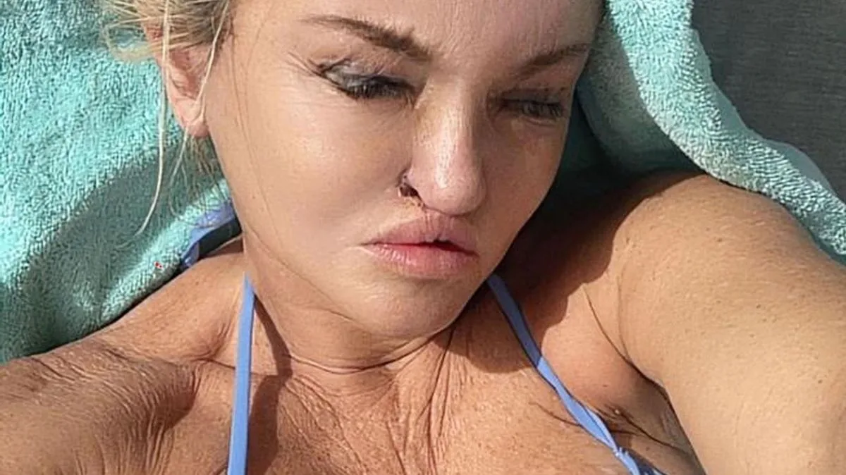 Danniella Westbrook Shows Off New Face After Dubai Surgery
