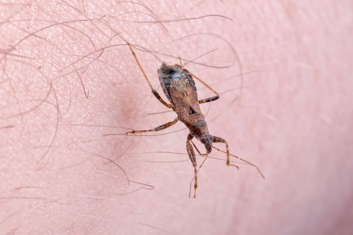 UK Health Officials Issue Warning Over Deadly 'Kissing Bug' Disease
