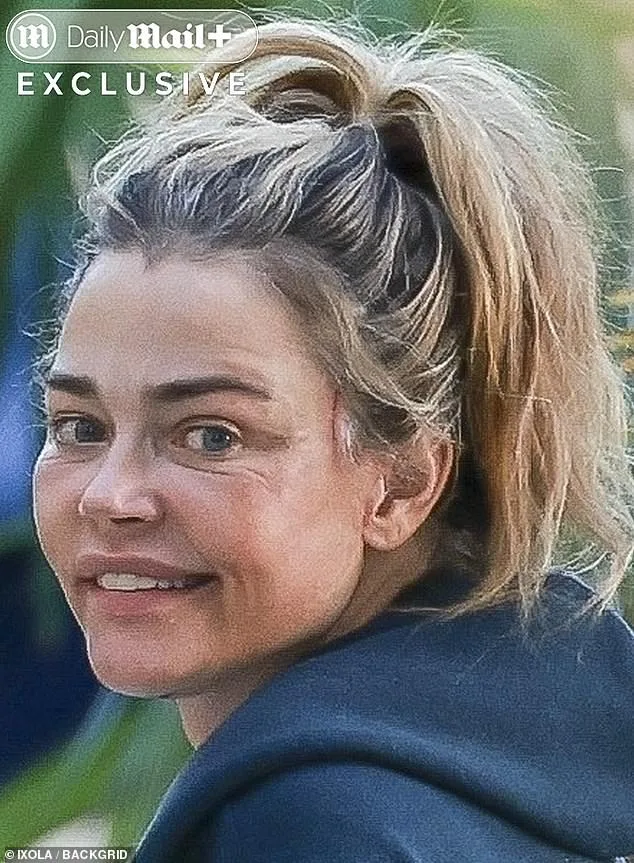 Denise Richards Sparks Facelift Fears Amid Ugly Divorce From Aaron Phypers